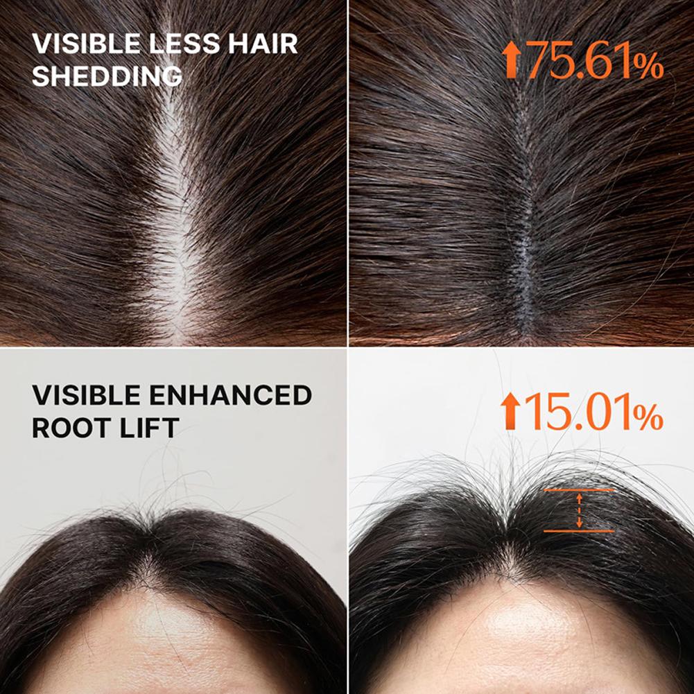 شامبو جرو:تيرن ثلاثي الأبعاد ل - مراجعة Hair Care For Hair Fall وسعره