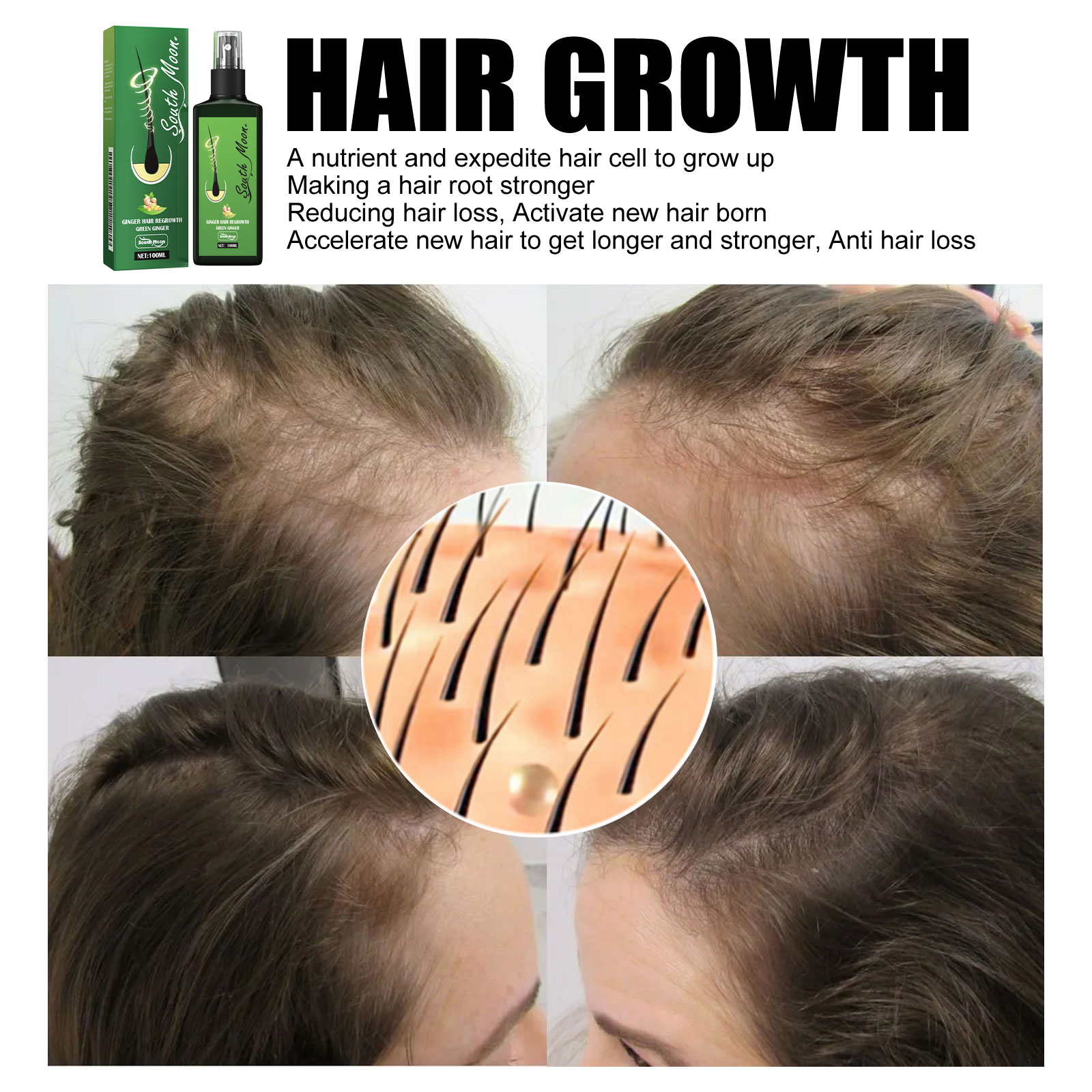 بخاخ سيروم الزنجبيل لتكثيف الش - مراجعة Hair Care For Hair Fall وسعره