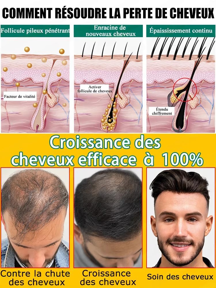 مصل مضاد لتساقط الشعر ومحفز لن - مراجعة Hair Care For Hair Fall وسعره