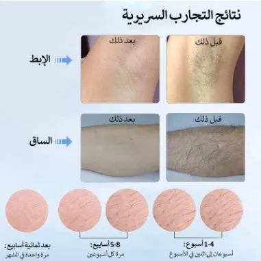 MLAY Factory T4 IPL الشعر المح - مراجعة Hair Care Japanese وسعره